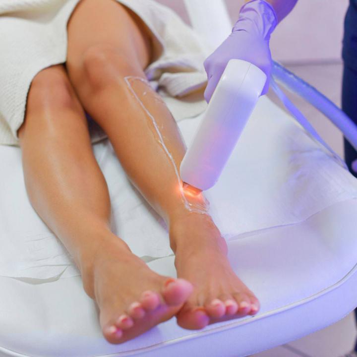 Laser hair removal | A popular cosmetic treatment